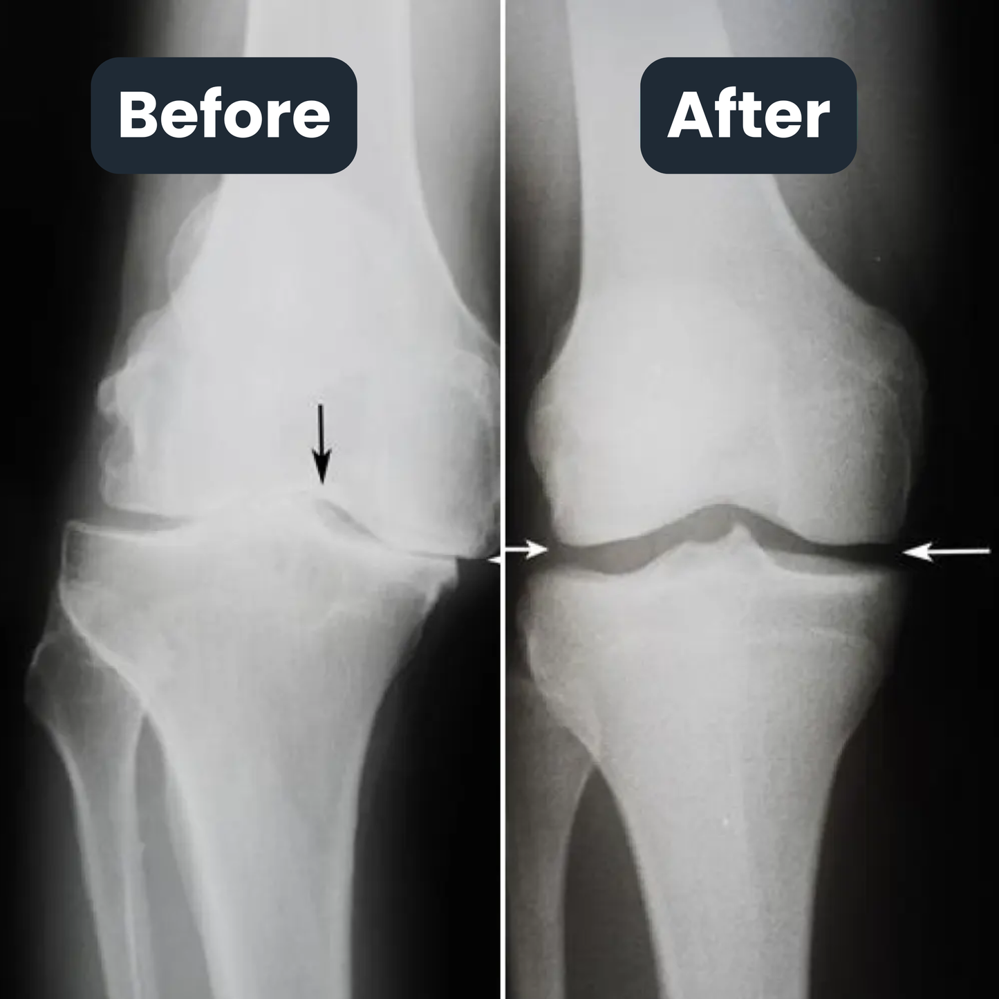 Knee Heat Therapy Relief Massager